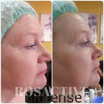 Программа для лица и тела BioTense. Ultra Подарки Тюмень. Подарочный сертификат на программу для лица и тела BioTense. Ultra Подарки Тюмень. 8 800-505-9503. Программа для лица и тела BioTense  #вМоскве#