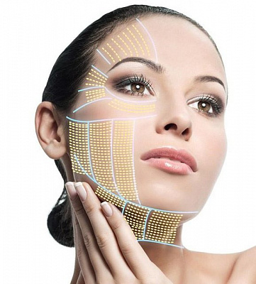 SMAS лифтинг лица. Ultra Подарки Тюмень. Подарочный сертификат на SMAS лифтинг лица. Ultra Подарки Тюмень. 8 800-505-9503. SMAS лифтинг лица  #вМоскве#