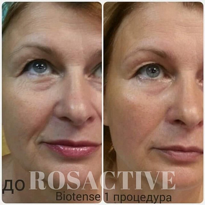 Программа для лица и тела BioTense. Ultra Подарки Тюмень. Подарочный сертификат на программу для лица и тела BioTense. Ultra Подарки Тюмень. 8 800-505-9503. Программа для лица и тела BioTense  #вМоскве#